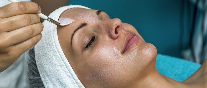 chemical-peels
