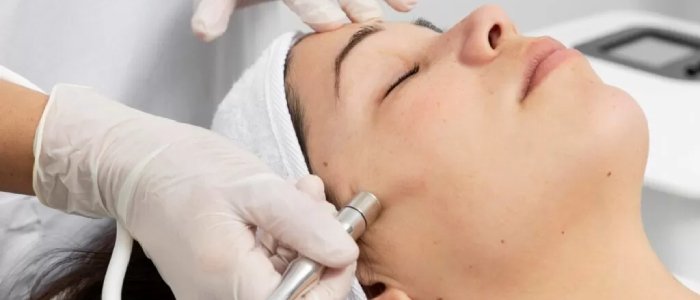 dermabrasion